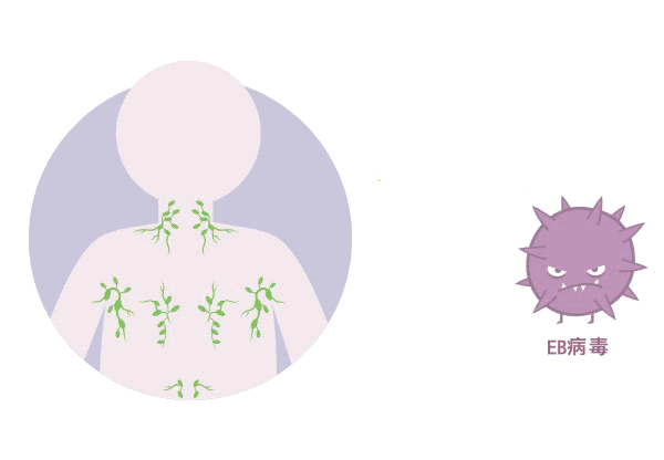 體檢查出“EB病毒”陽性！一定就是鼻咽癌嗎？