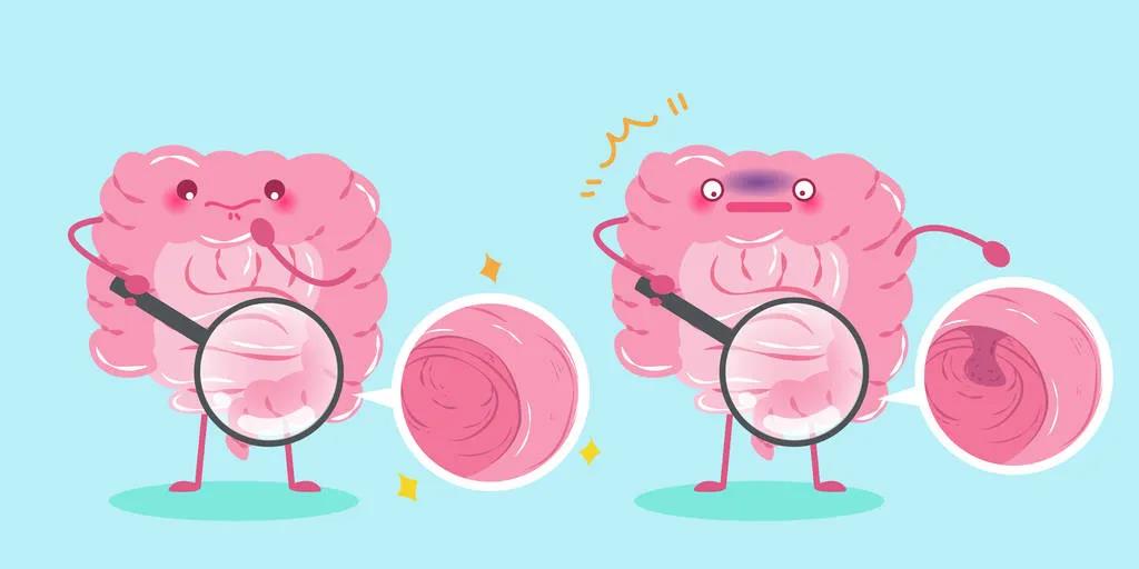 因?yàn)楹鲆暽眢w出現(xiàn)的這些變化，他們最后被確診結(jié)腸癌