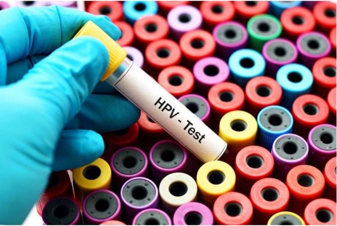 HPV分型檢測的重要性