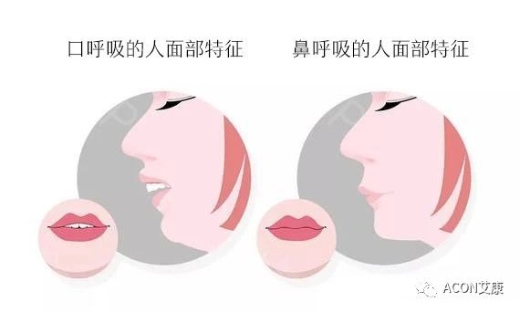 過敏性鼻炎會(huì)讓孩子變傻？！家長(zhǎng)該如何應(yīng)對(duì)